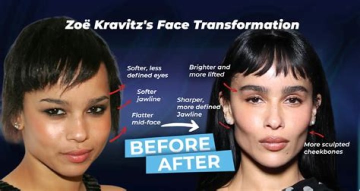 Zoe Kravitz Plastic Surgery How Many Plastic Surgeries She Had? Lake