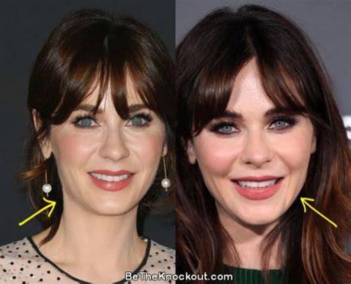 Zooey Deschanel Plastic Surgery Botox, Nose Job, Before and After
